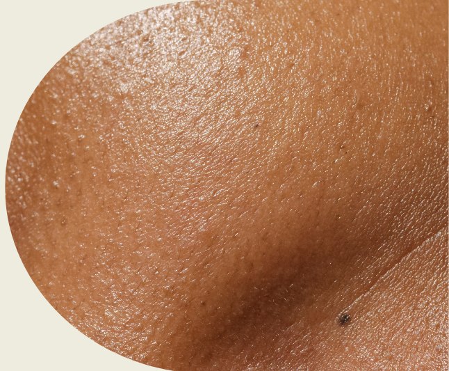 Close-up of skin on an arm