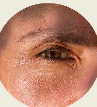 Close-up of an eye area