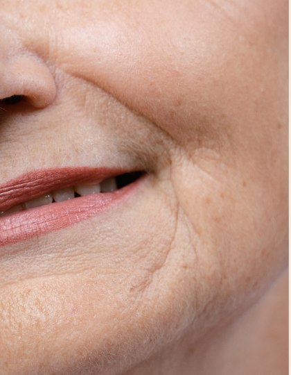Close-up of facial skin
