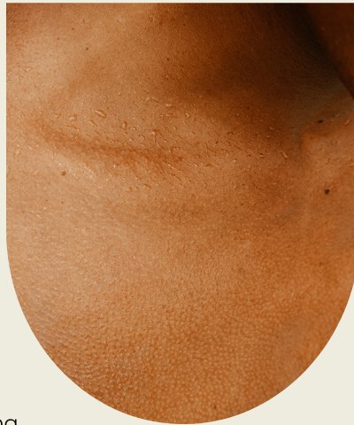 Close-up of neck skin