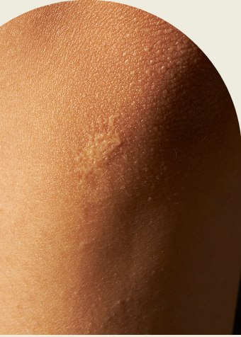 Close-up of skin texture