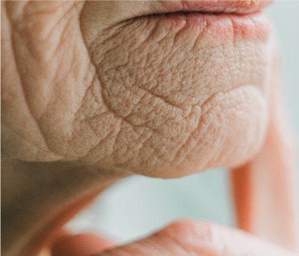 Close-up of aged skin